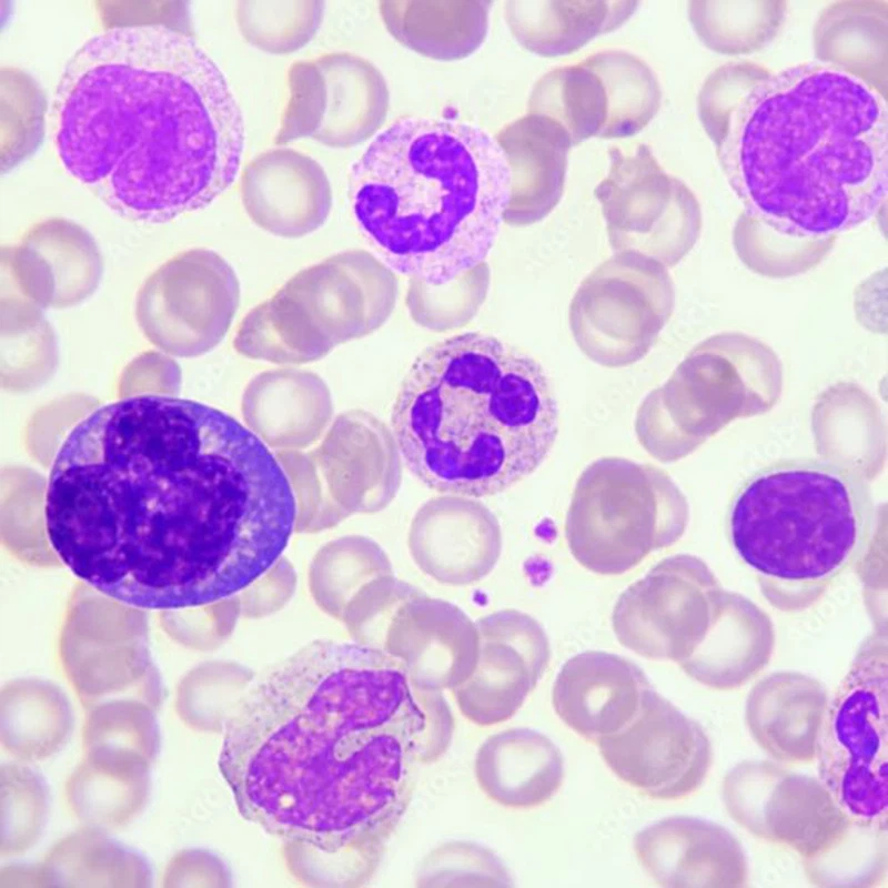 acepromazine maleate injection use | Shaanxi BLOOM Tech Co., Ltd acepromazine maleate injection use | Shaanxi BLOOM Tech Co., Ltd