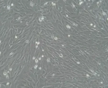 Andarine(S4) proliferation | Shaanxi BLOOM Tech Co., Ltd Andarine(S4) proliferation | Shaanxi BLOOM Tech Co., Ltd